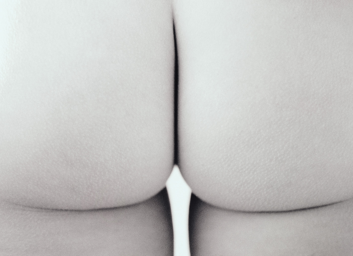 Buttock augmentation using the tower technique and the heavily cross-linked hyaluronic acid Macrolane™. Buttock augmentation using the tower technique and the heavily cross-linked hyaluronic acid Macrolane™.