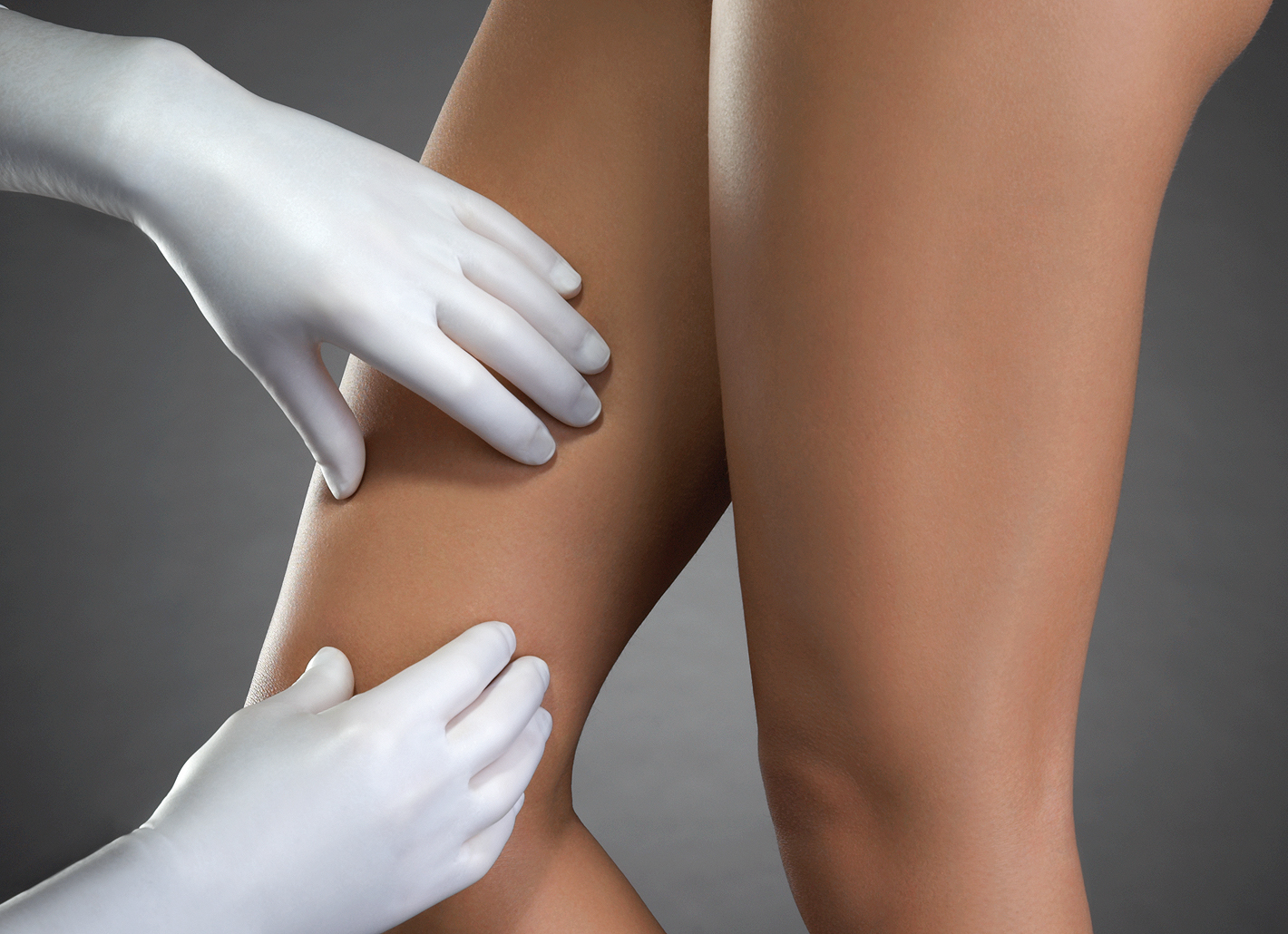 The specialists at Rosenpark Clinic probe the causes of spider veins and varicose veins with a great deal of expert knowledge and recommend practical treatment methods. The specialists at Rosenpark Clinic probe the causes of spider veins and varicose veins with a great deal of expert knowledge and recommend practical treatment methods.