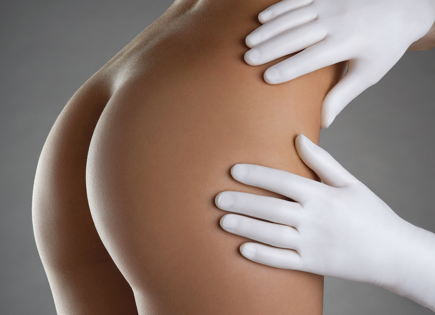 With a buttock lift, the surgeon tightens excess skin fat and places the incision in the gluteal crease. With a buttock lift, the surgeon tightens excess skin fat and places the incision in the gluteal crease.